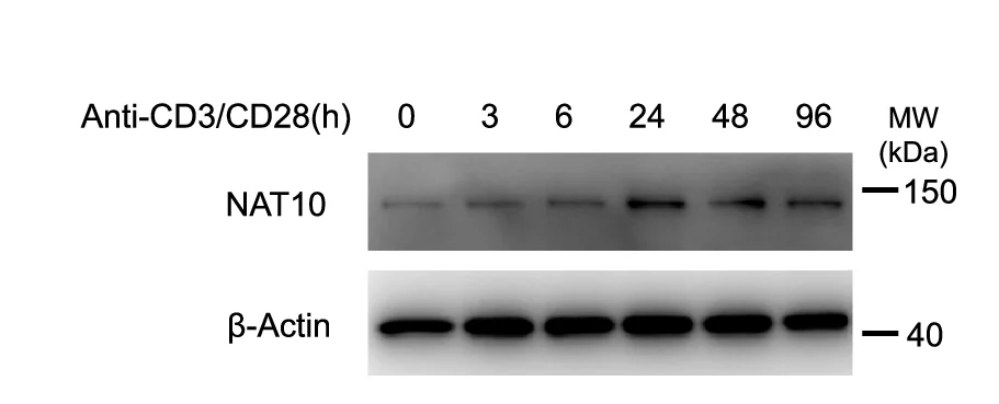 Open access visualization of Gel, Naive CD4+ T Cells, T Cell Stimulation, NAT10 Protein, Protein Expression