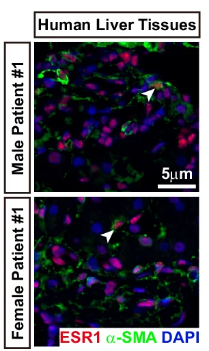 Open access visualization of Microscopy, Paraffin Sections, Liver Tissue, Immunofluorescence, Alpha-SMA