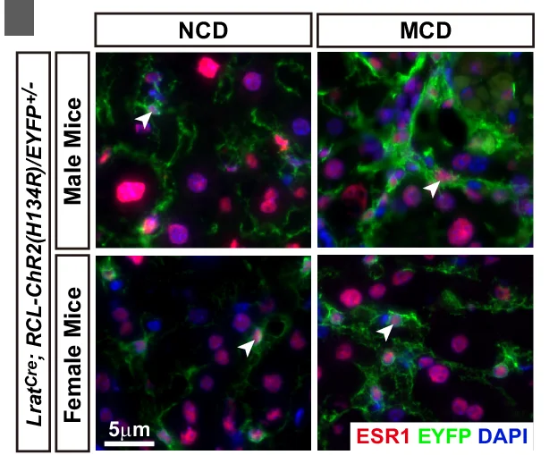 Open access visualization of Microscopy, Lrat Cre Mice, NCD Diet, MCD Diet, Liver Fibrosis
