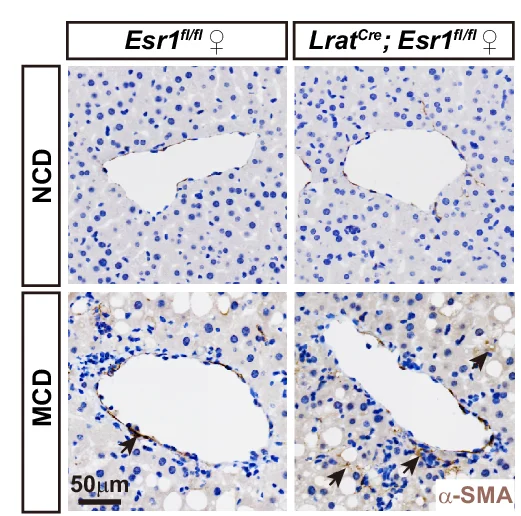 Open access visualization of Microscopy, Lrat Cre Mice, Esr1 fl/fl Mice, NCD Diet, MCD Diet