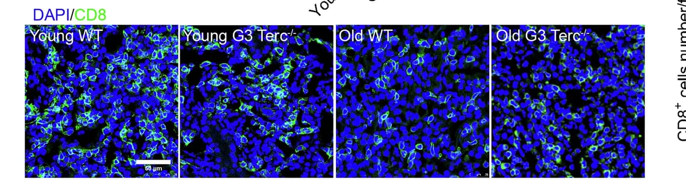 Open access visualization of Microscopy, CD8+ T Cells, Immunofluorescent Staining, Allografts, Quantitative Analysis