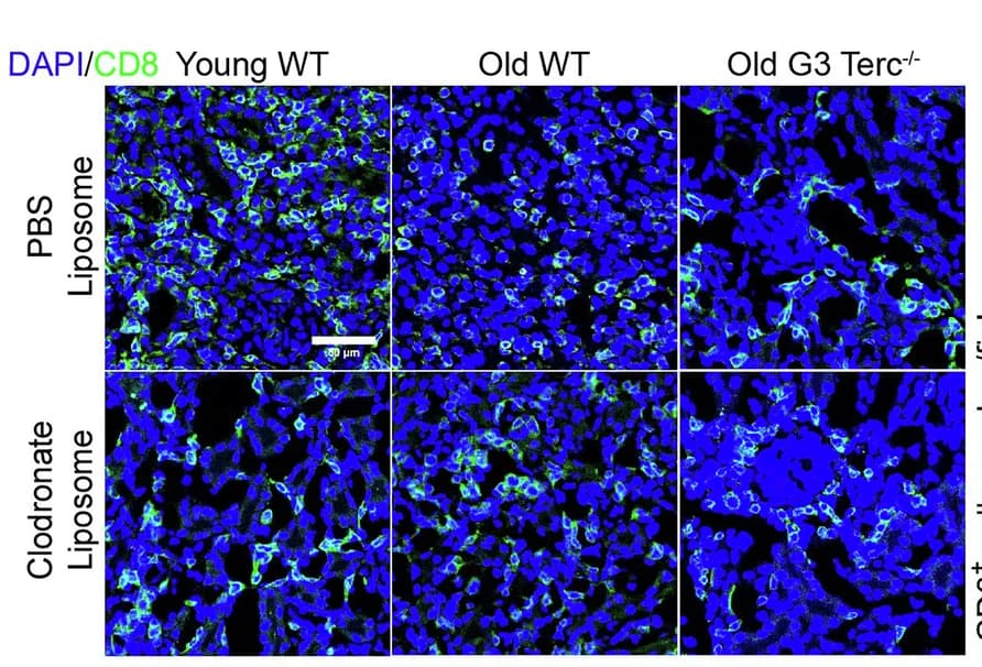 Open access visualization of Microscopy, CD8+ T Cells, Immunofluorescent Staining, Allografts, Quantitative Analysis