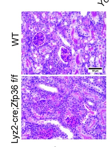 Open access visualization of Microscopy, PAS Staining, Allografts