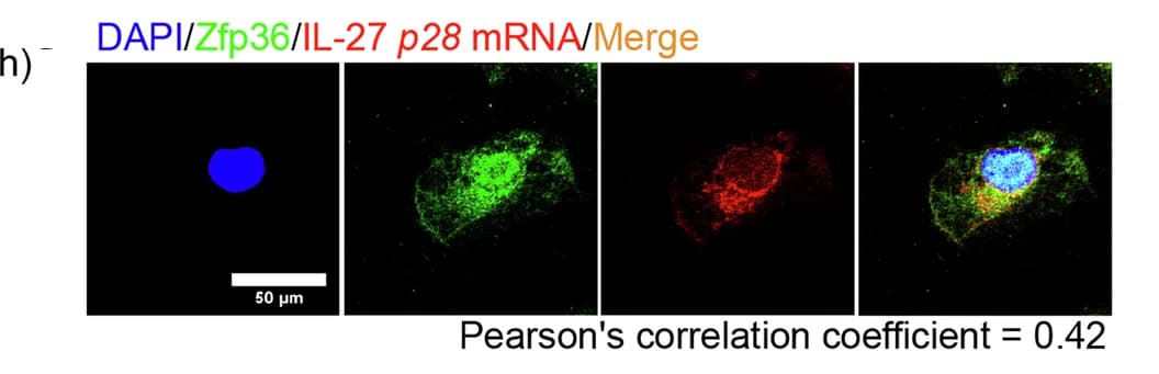 Open access visualization of Microscopy, Confocal Microscopy, Colocalization, Zfp36, IL-27 p28 mRNA