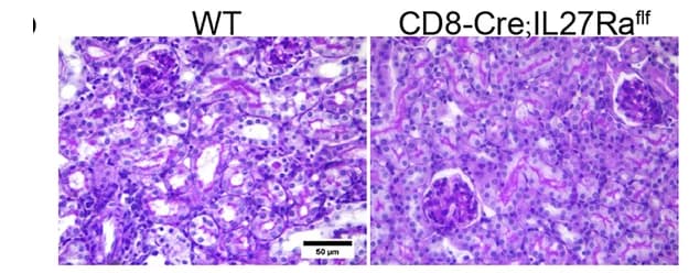 Open access visualization of Microscopy, PAS Staining, Allografts