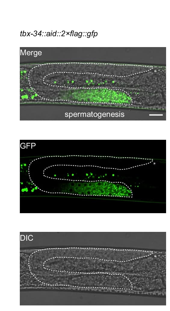Open access visualization of Microscopy, Marker Genes, Spermatogenic Cell, L4 Worm, Gonad Arm