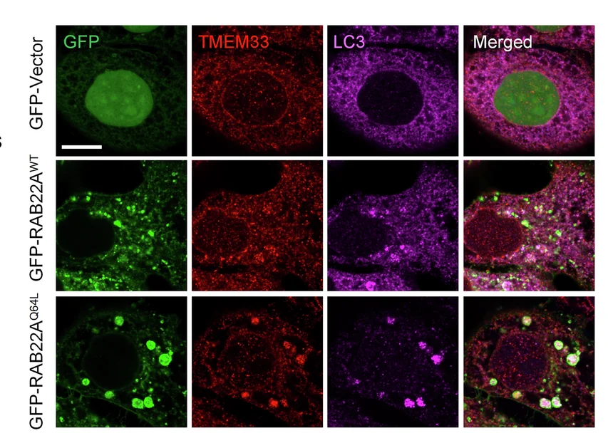 Open access visualization of Microscopy, TMEM33, LC3, GFP-Vector, GFP-RAB22A WT