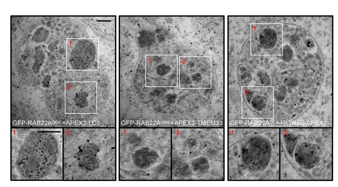 Open access visualization of Microscopy, Electron Microscopy, LC3, TMEM33, RTN4B
