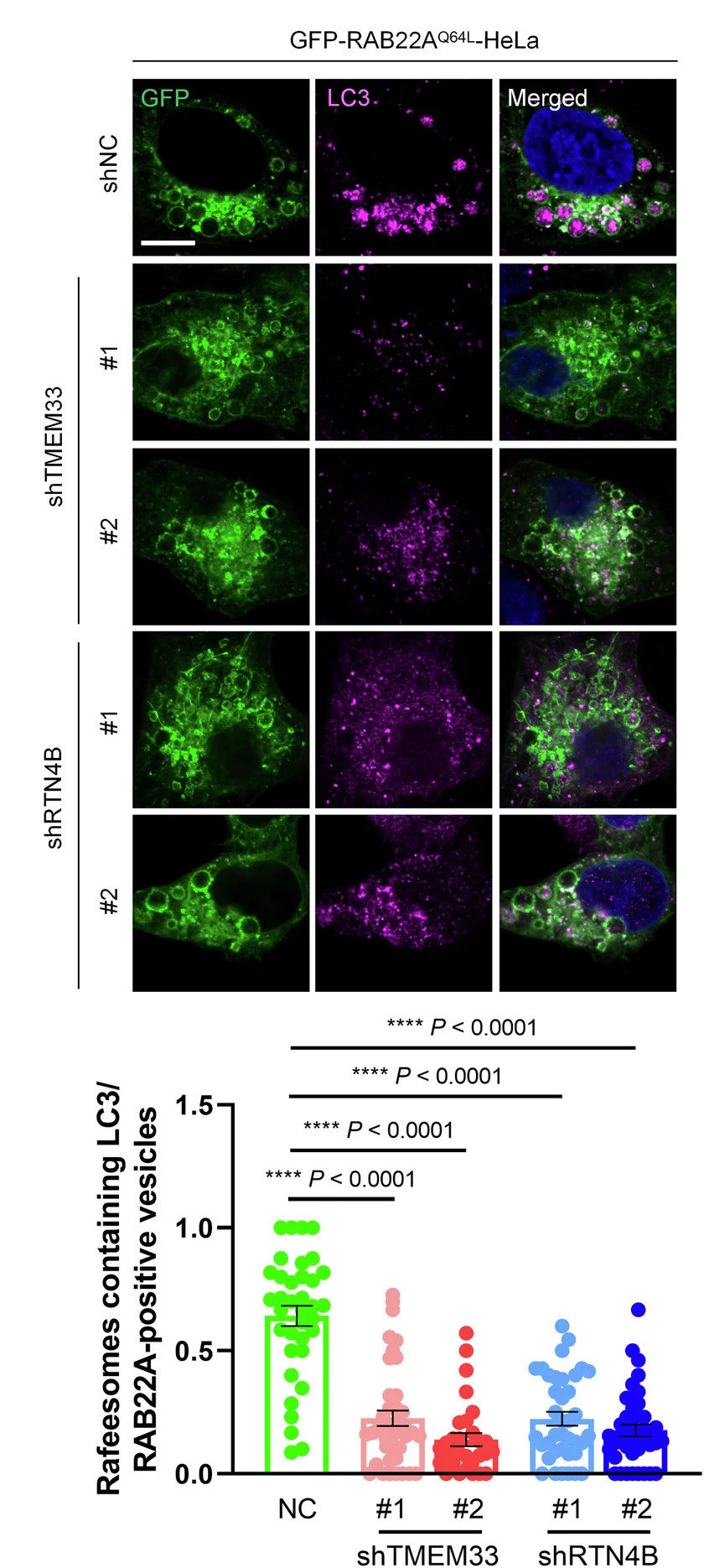 Open access visualization of Microscopy, HeLa Cells, GFP-RAB22A Q64L, TMEM33 Knockdown, RTN4B Knockdown
