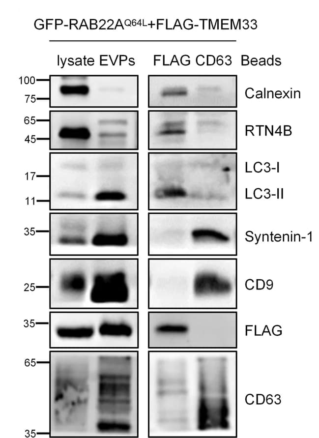 Open access visualization of Gel, Cell Lysates, Total EVPs, Anti-FLAG, Anti-CD63