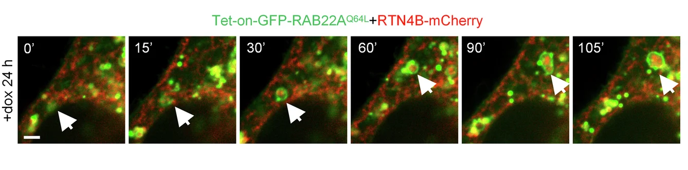 Open access visualization of Microscopy, HeLa Cells, RTN4B-mCherry, Rafeesomes, Time-Lapse Imaging