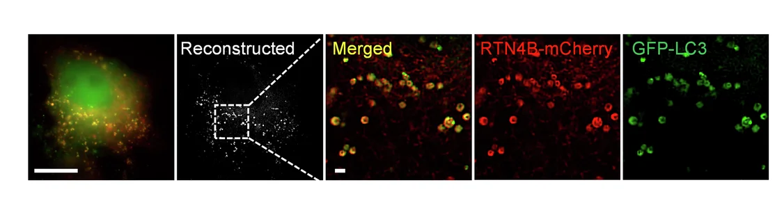 Open access visualization of Microscopy, Multi-SIM Analysis, RTN4B-mCherry, HeLa Cells, GFP-LC3