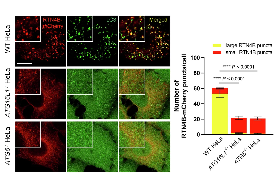 Open access visualization of Bar Plot, Stacked Bar Plot, Error Bars, Microscopy, HeLa Cells