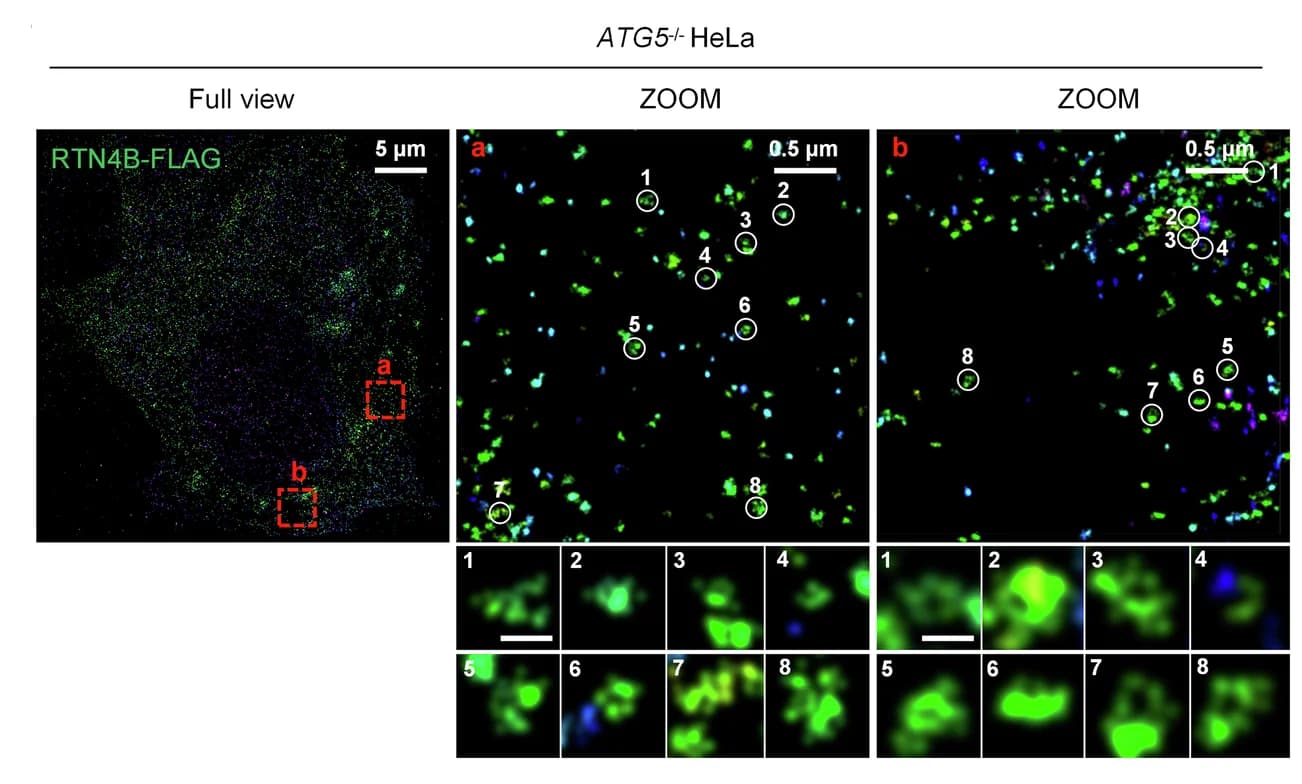 Open access visualization of Microscopy, 3D-STORM, RTN4B-FLAG, ATG5, HeLa Cells
