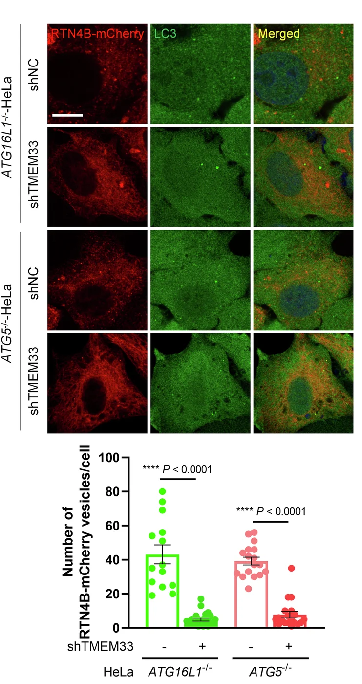 Open access visualization of Microscopy, Bar Plot, Error Bars, Scatter Plot, ATG16L1