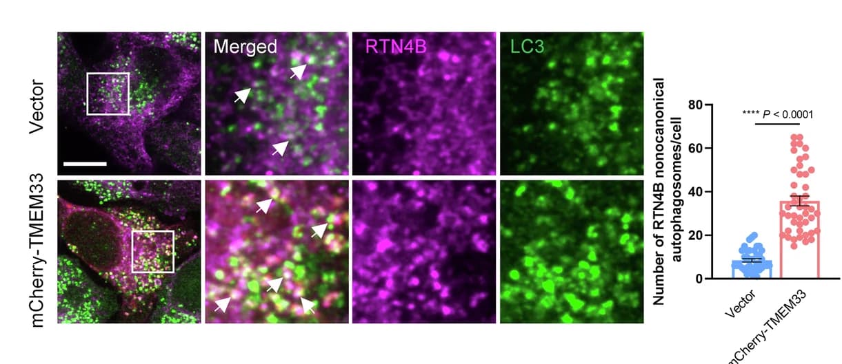 Open access visualization of Microscopy, Bar Plot, Error Bars, HeLa Cells, mCherry-TMEM33