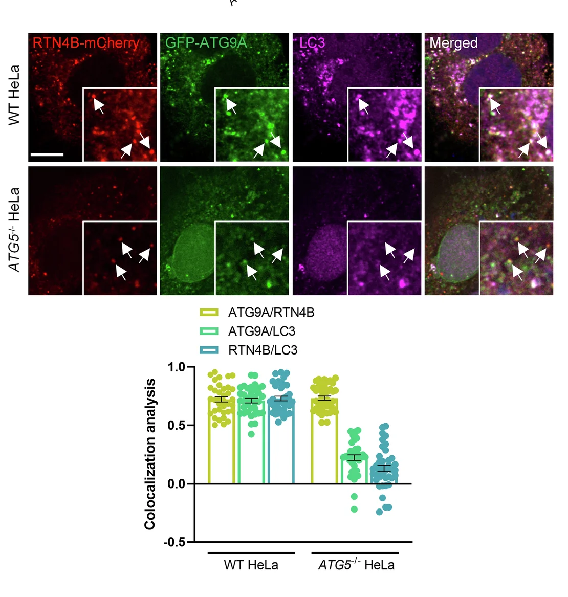 Open access visualization of Microscopy, Scatter Plot, Error Bars, GFP-ATG9A, LC3