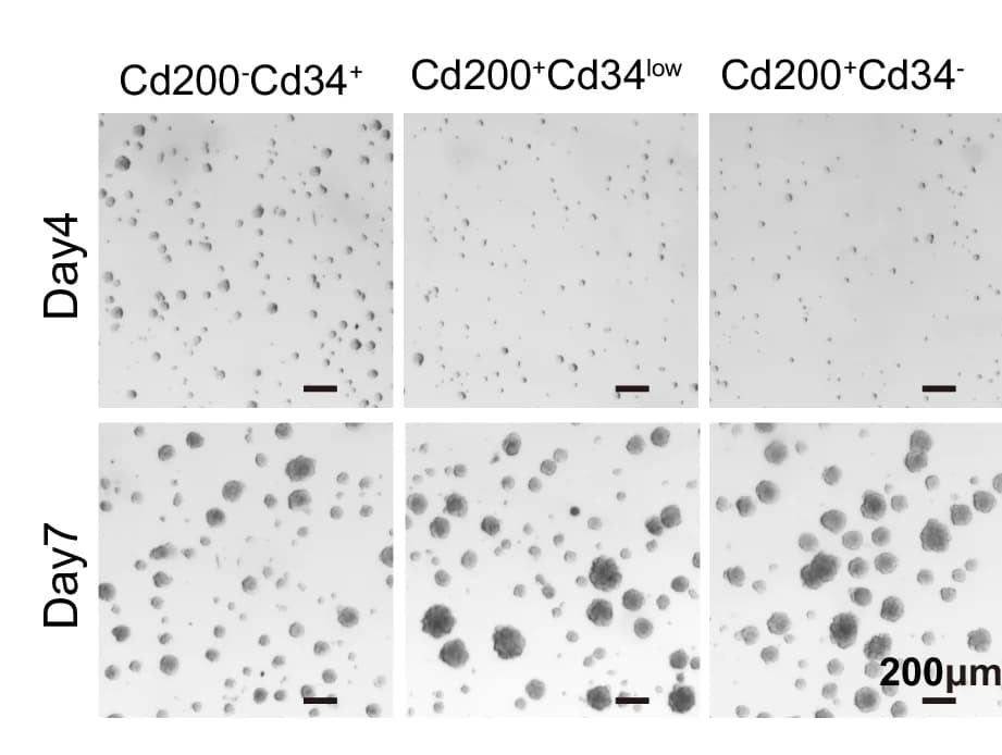 Open access visualization of Microscopy, Colony Formation Assay, CD200-CD34+, CD200+CD34low, CD200+CD34-
