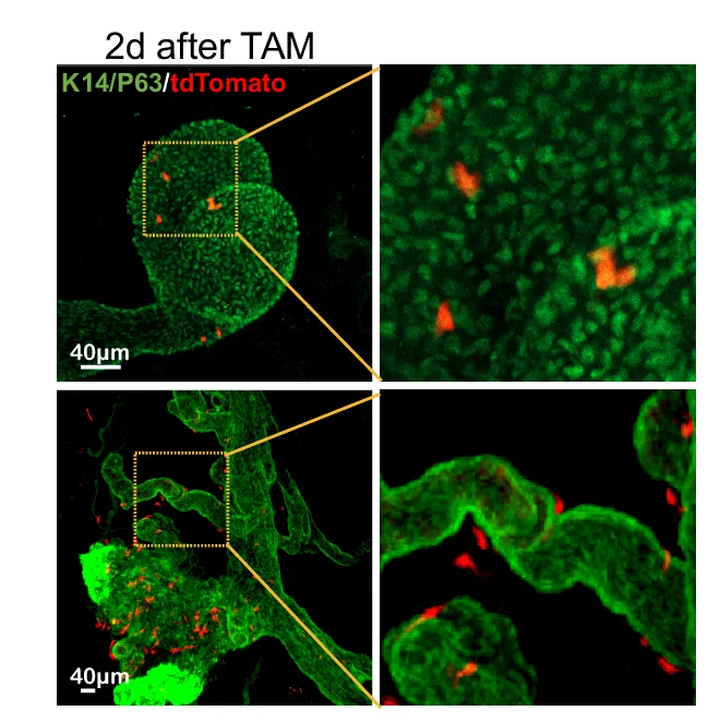 Open access visualization of Microscopy, Tissue Clearing, Immunofluorescence Staining, tdTomato Cells, Basal Markers