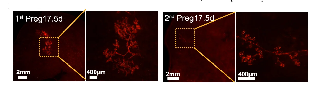 Open access visualization of Microscopy, Fluorescence Images, tdTomato-positive Clones, Mammary Gland, Pregnancy