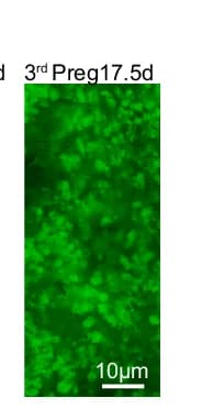 Open access visualization of Microscopy, Fluorescence Image, Krt14-traced Positive Clones, Mammary Gland, Pregnancy