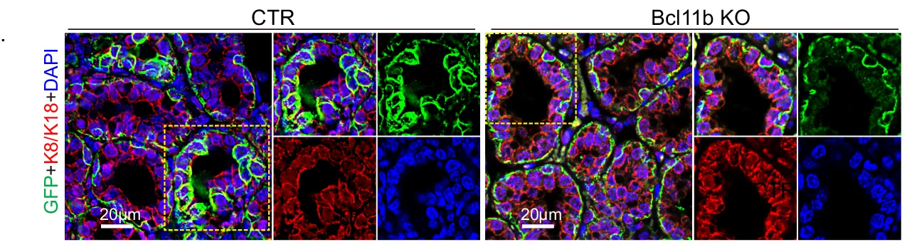 Open access visualization of Microscopy, GFP-positive Clones, Immunofluorescence, GFP, Krt8/18