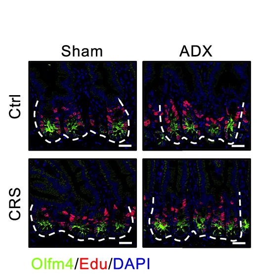 Open access visualization of Microscopy, EdU Staining, Olfm4 Staining, Jejuna, Sham + Ctrl Mice