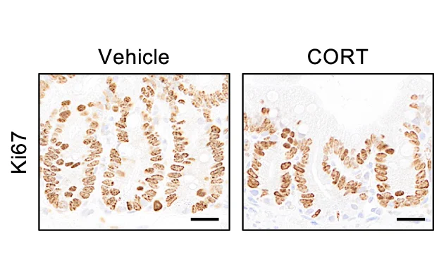 Open access visualization of Microscopy, Ki-67 Staining, Jejuna, Mice, Vehicle