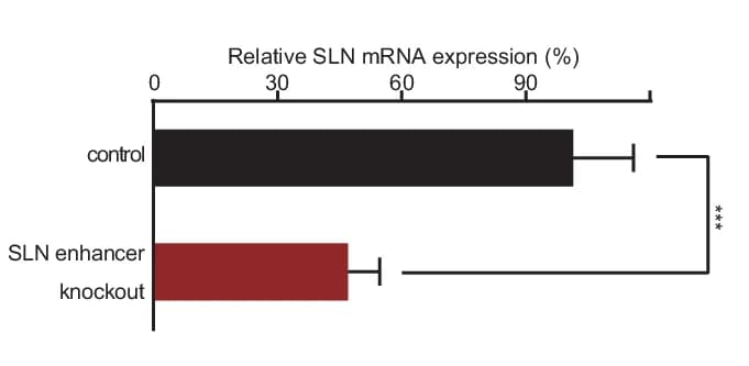 Open access visualization of Bar Plot, Error Bars, Gene Expression, Control, SLN Enhancer