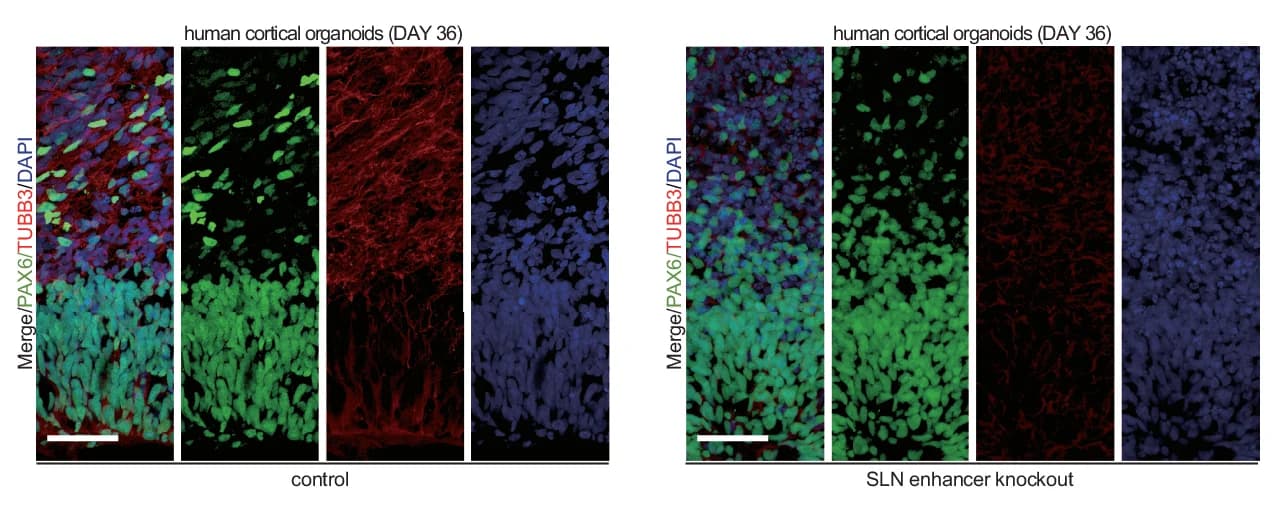 Open access visualization of Microscopy, Immunostaining, PAX6, TUBB3, DAPI