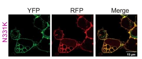 Open access visualization of Microscopy, Subcellular Localization, CTD, CRT Variants, N331K