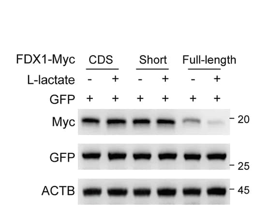 Open access visualization of Gel, Immunoblot Analysis, FDX1 Protein Levels, GFP Protein Levels, KYSE30 Cells
