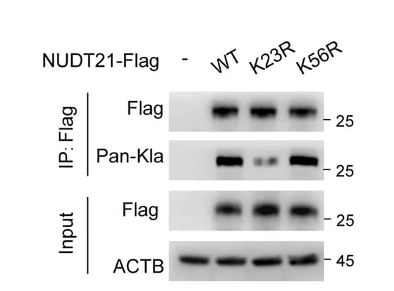 Open access visualization of Gel, Immunoblot Analysis, NUDT21 Lactylation, KYSE30 Cells, NUDT21 Mutant Plasmids