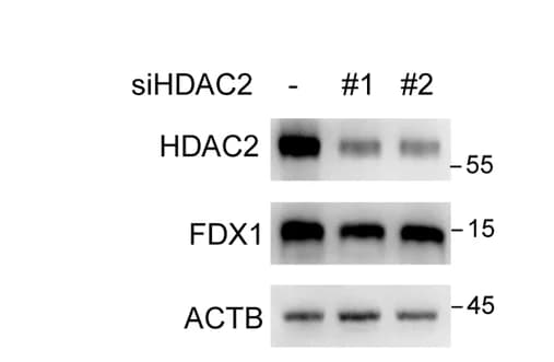 Open access visualization of Gel, Immunoblot Analysis, FDX1 Protein Levels, KYSE30 Cells, siRNAs