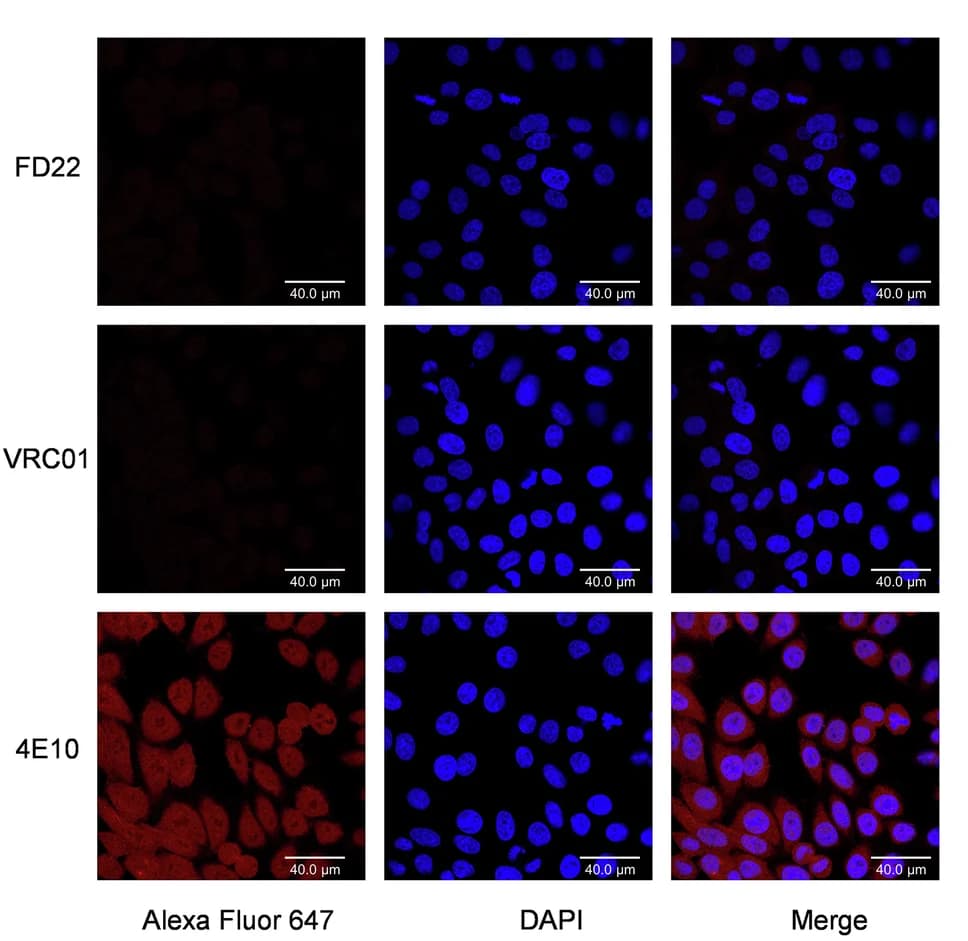 Open access visualization of Microscopy, HEp-2 Assay, FD22, Autoreactivity