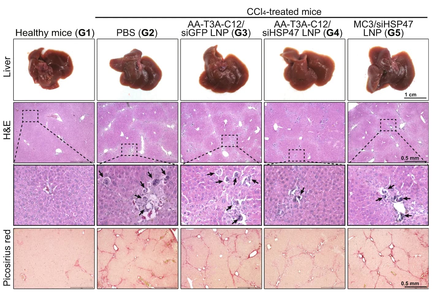 Open access visualization of Microscopy, Photo, Liver, Liver Sections, Hematoxylin and Eosin