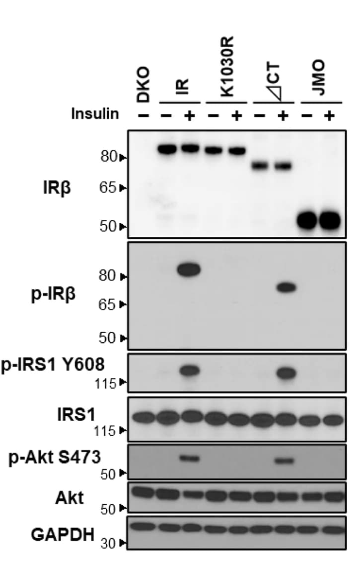 Open access visualization of Gel, Immunoblotting, Phosphorylation, Receptor Protein, IRS-1
