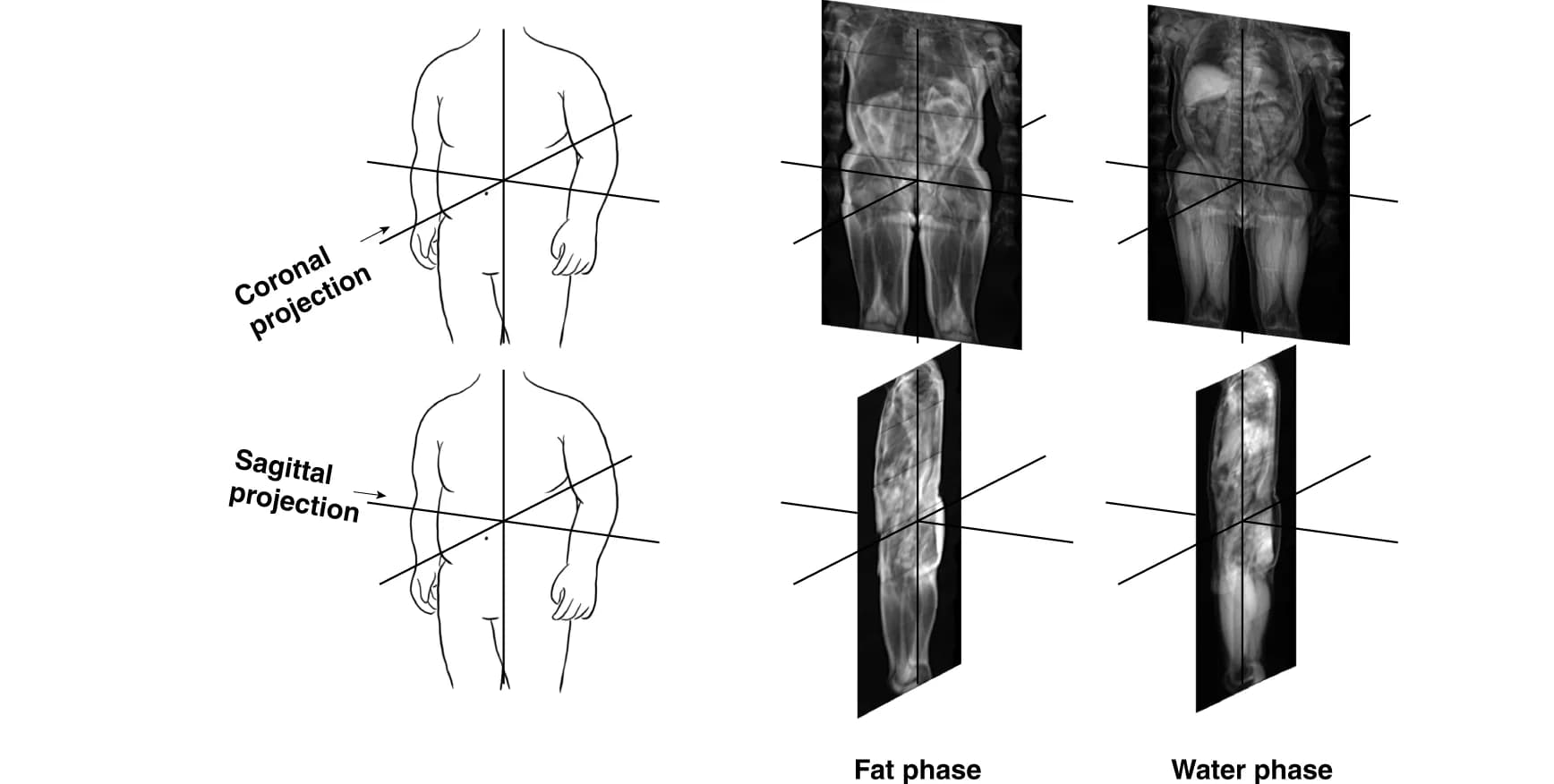 Open access visualization of Microscopy, Illustration, MRI, Convolutional Neural Network, Fat phase