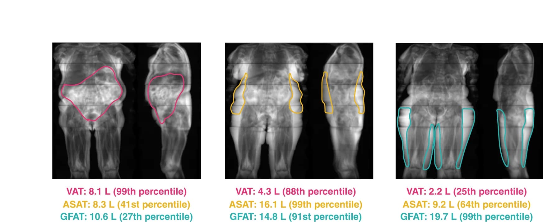 Open access visualization of Microscopy, Female Participants, BMI, Fat depot volumes, Convolutional Neural Networks