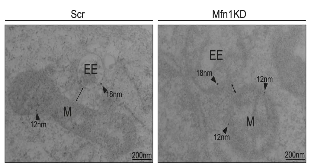Open access visualization of Microscopy, Immunogold staining, Rab5, SdhA, Myoblasts