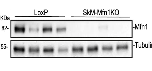 Open access visualization of Gel, Immunoblot, Quadriceps Muscles, Mfn1, Tubulin