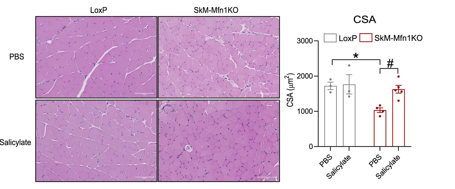 Open access visualization of Bar Plot, Error Bars, Microscopy, Hematoxylin/Eosin Staining, Gastrocnemius Muscles