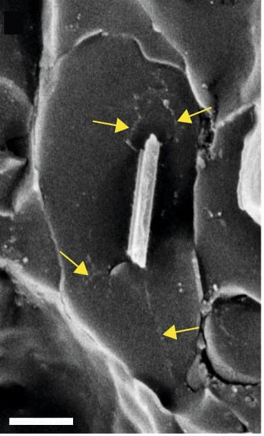 Open access visualization of Microscopy, Cryo-SEM, Guanine Crystal, Intraluminal Fibrils