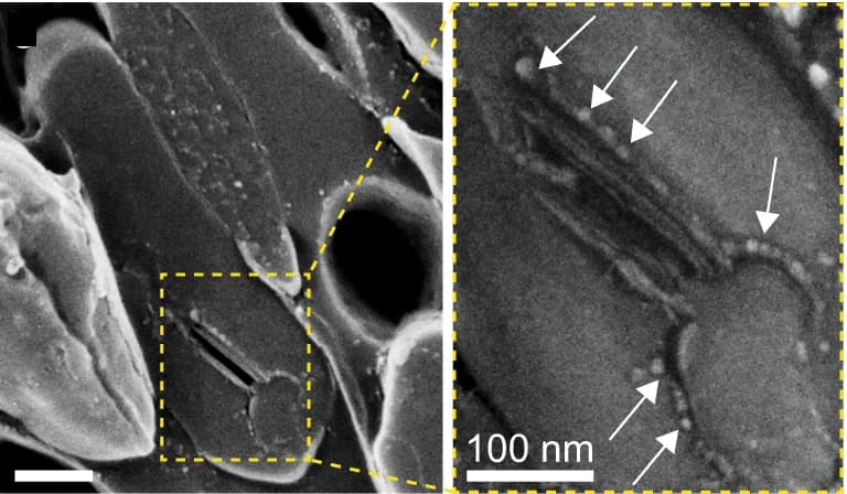 Open access visualization of Microscopy, Cryo-SEM, Crystal Nucleation, Intraluminal Sheets, Globules