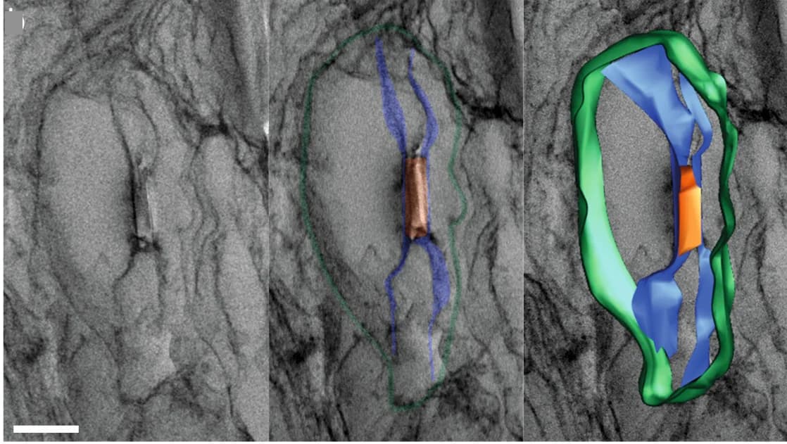 Open access visualization of Microscopy, Crystals, Platelets