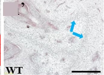 Open access visualization of Microscopy, CsALC, Transmitting Tract, WT Ovaries, In Situ Hybridization