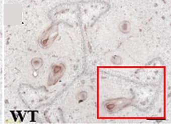 Open access visualization of Microscopy, CsRALF4, Transmitting Tract, WT Ovaries, In Situ Hybridization