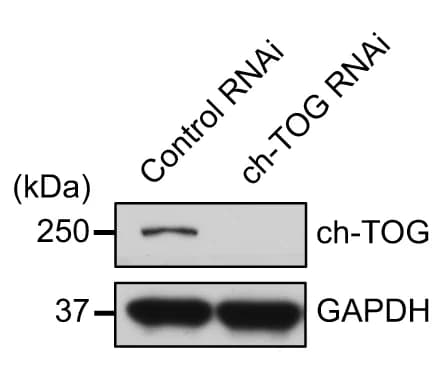 Open access visualization of Gel, U2OS Cells, ch-TOG, siRNA, Immunoblot