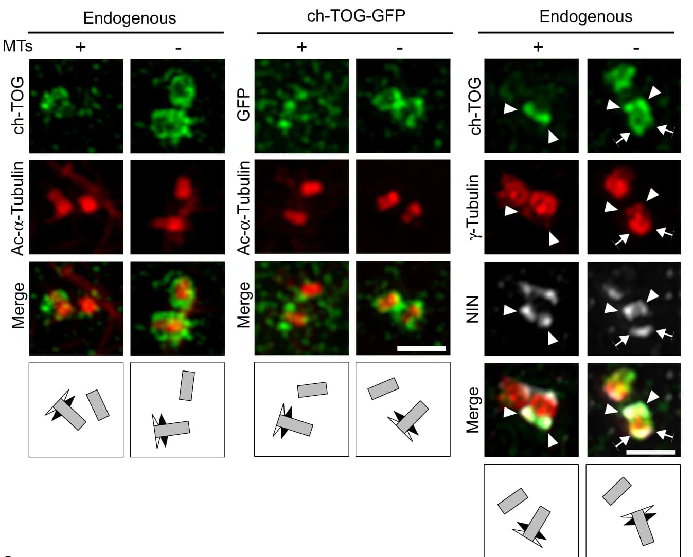 Open access visualization of Microscopy, Centrosomes, ch-TOG, Microtubules, Acetylated α-tubulin