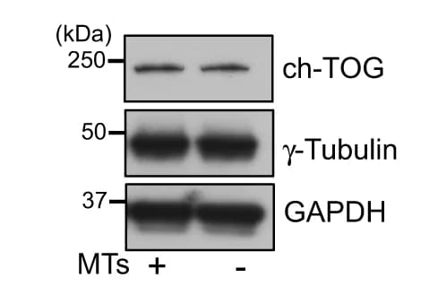 Open access visualization of Gel, Cell Lysates, U2OS Cells, Microtubules, Immunoblot